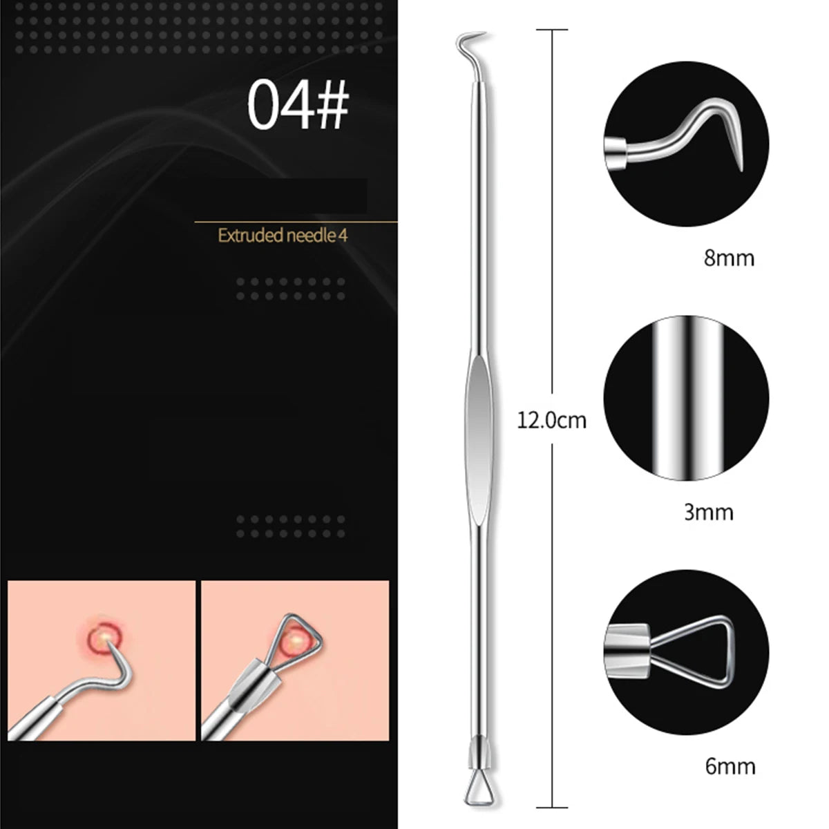 4PCS Acne Blackhead Comedone Black Spot Pimple Blemish Remover Skin Care Women Beauty Acne Treatment Pore Cleanser Needle Hook