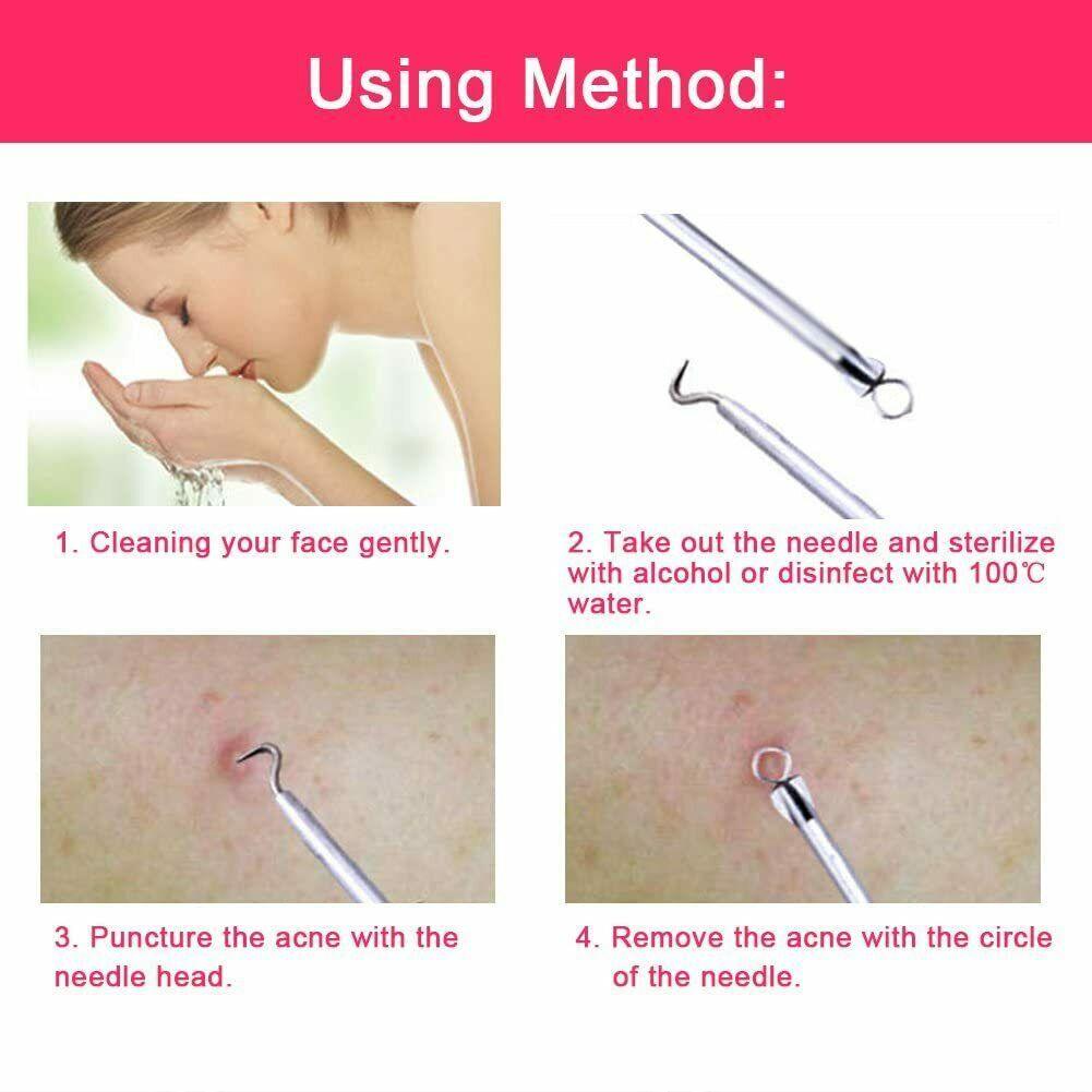 Ear Wax Remover Spoon Earwax Picker And Pimple Blackhead Remover Tools - COMBO KIT - fadidesign